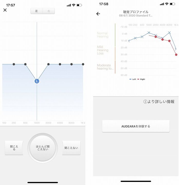 自分の耳に最適化した音を届けるワイヤレスヘッドホン Audeara オーディラ A 01 を試してみた Appbank Store